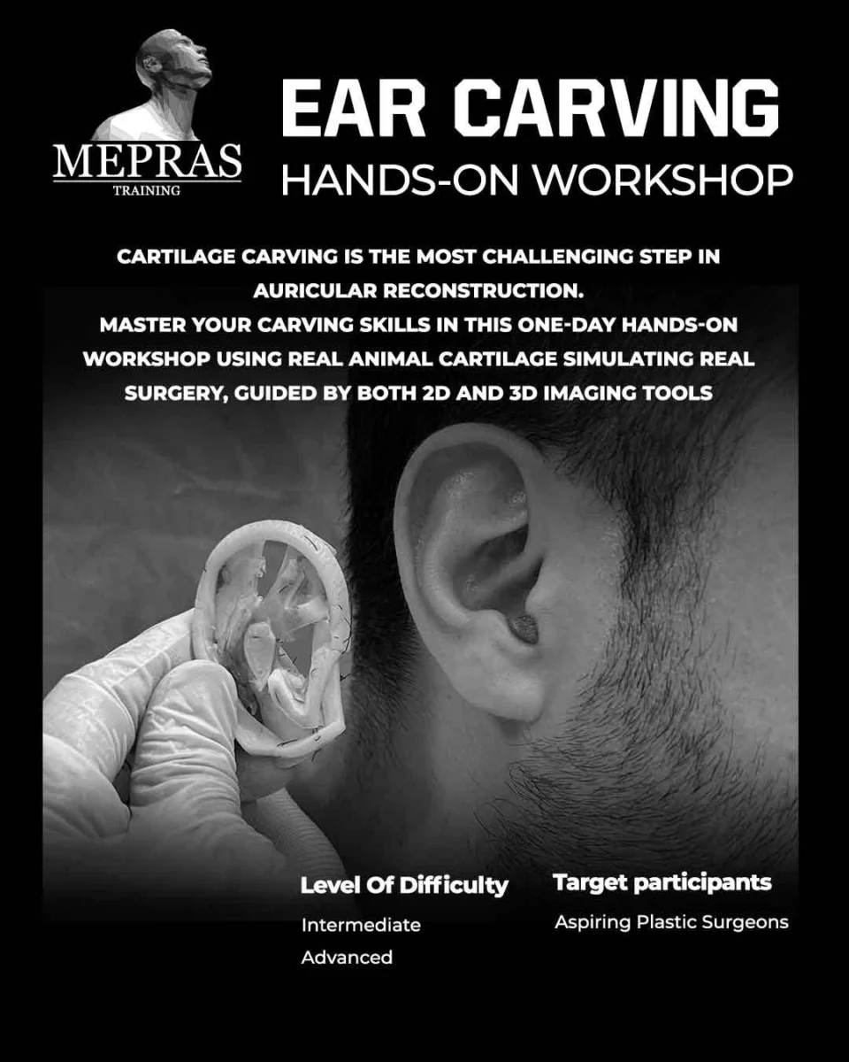 Ear Carving (Hands-on Workshop) (MEPRAS)